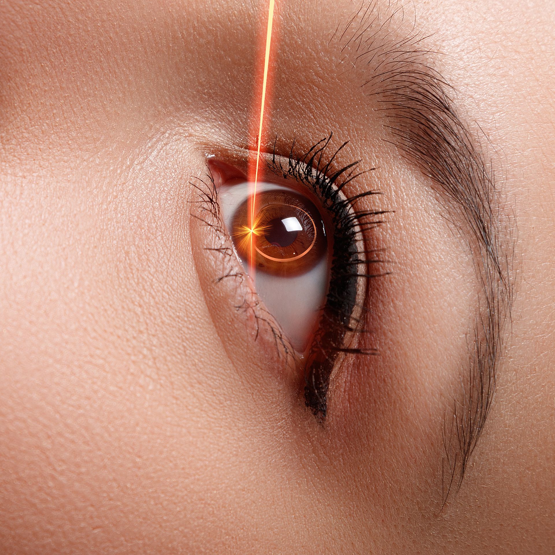Laser Eye Surgery